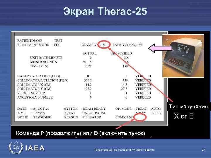 Экран Therac-25 Тип излучения Команда Р (продолжить) или В (включить пучок) IAEA Предотвращение ошибок
