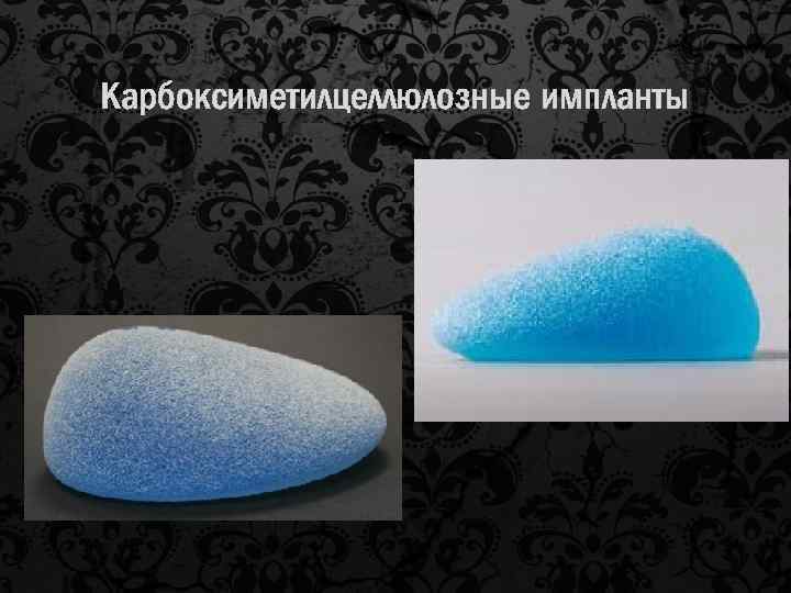 Карбоксиметилцеллюлозные импланты 