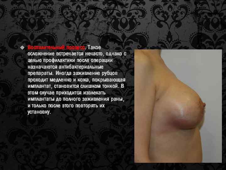  Воспалительный процесс. Такое осложнение встречается нечасто, однако с целью профилактики после операции назначаются
