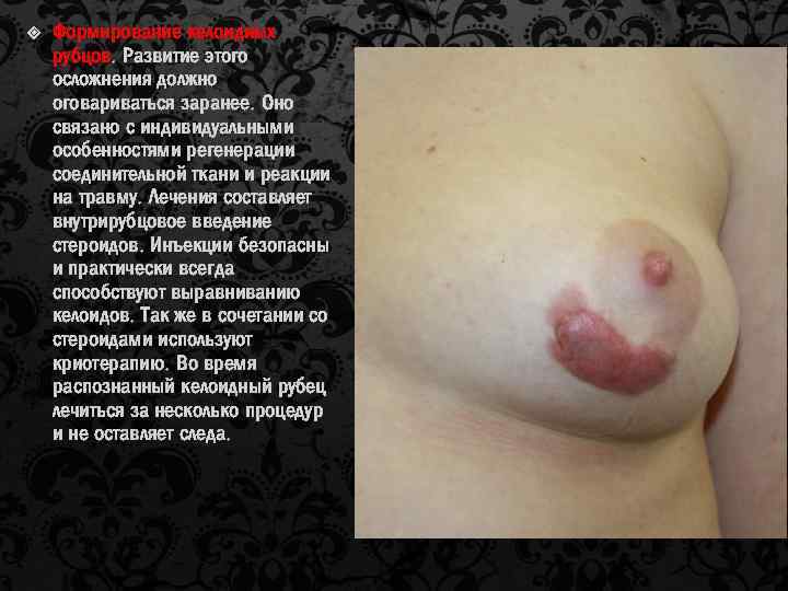  Формирование келоидных рубцов. Развитие этого осложнения должно оговариваться заранее. Оно связано с индивидуальными