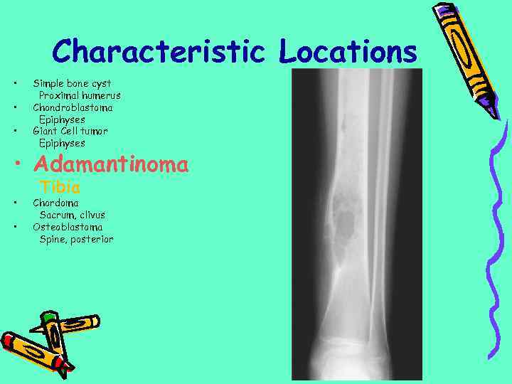 Characteristic Locations • • • Simple bone cyst Proximal humerus Chondroblastoma Epiphyses Giant Cell