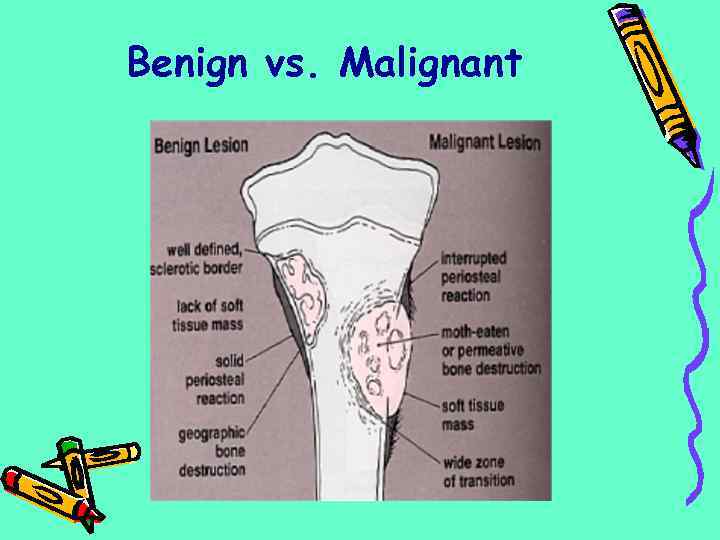 Benign vs. Malignant 