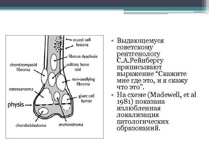 Опухоли костей схема