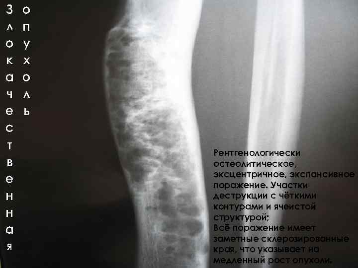 З л о к а ч е с т в е н н а