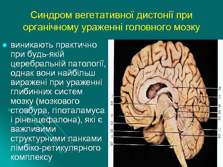 Синдром вегетативної дистонії при органічному ураженні головного мозку l виникають практично при будь-якій церебральній