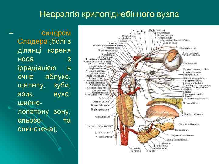 Невралгія крилопіднебінного вузла – синдром Сладера (болі в ділянці кореня носа з іррадіацією в