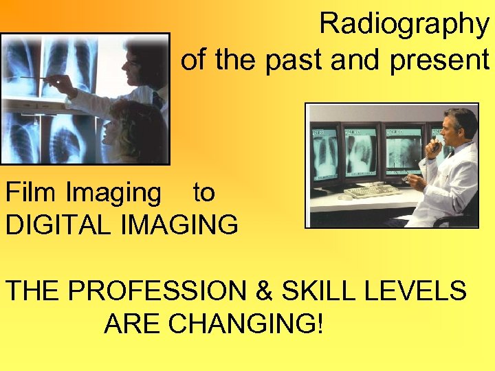 Radiography of the past and present Film Imaging to DIGITAL IMAGING THE PROFESSION &