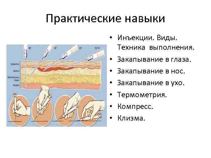 Практические навыки • Инъекции. Виды. Техника выполнения. • Закапывание в глаза. • Закапывание в