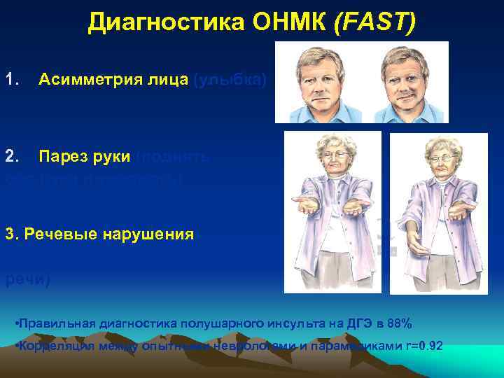 Диагностика ОНМК (FAST) 1. Асимметрия лица (улыбка) 2. Парез руки (поднять обе руки и