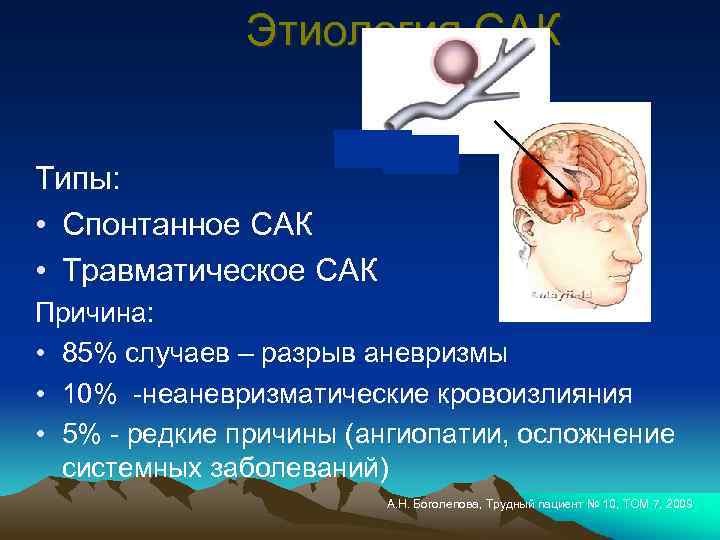 Этиология САК Типы: • Спонтанное САК • Травматическое САК Причина: • 85% случаев –