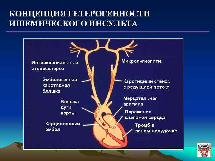 Интракраниальные артерии головного мозга