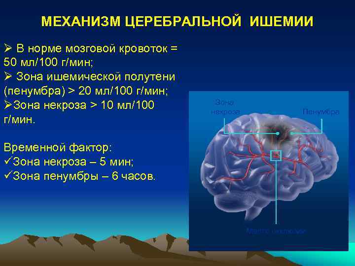 Зона ишемии. Зоны мозга при ишемическом инсульте. Зона ишемической полутени. Зоны инфаркта головного мозга. Церебральная форма инфаркта.