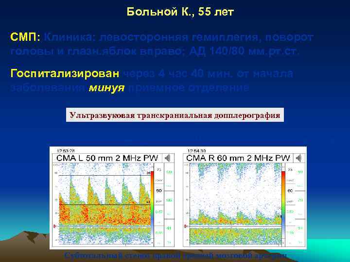Больной К. , 55 лет СМП: Клиника: левосторонняя гемиплегия, поворот головы и глазн. яблок