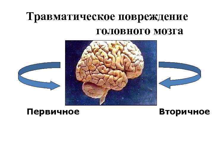 Травматическое повреждение головного мозга Первичное Вторичное 