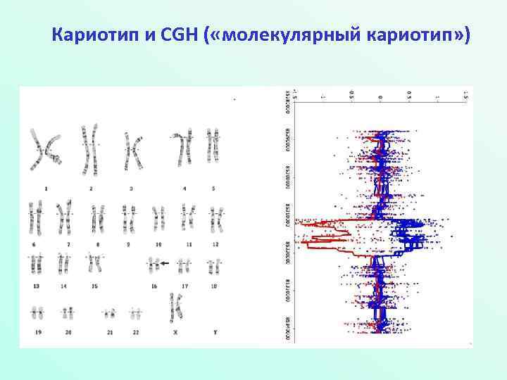 Кариотип и CGH ( «молекулярный кариотип» ) 