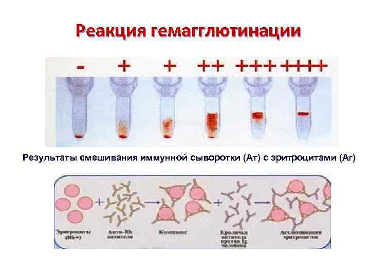 Реакция гемагглютинации Результаты смешивания иммунной сыворотки (Ат) с эритроцитами (Аг) 