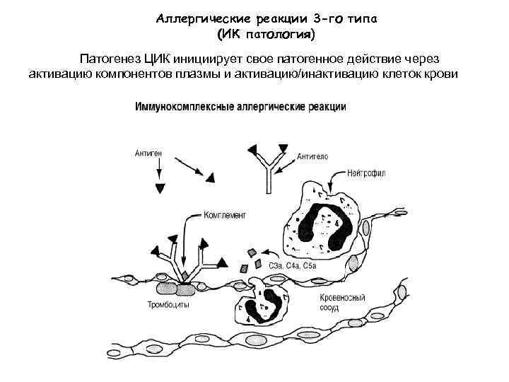 Аллергические реакции 3 -го типа (ИК патология) Патогенез ЦИК инициирует свое патогенное действие через