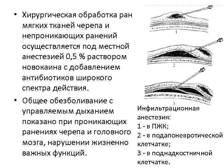 Резаная рана волосистой части головы карта вызова