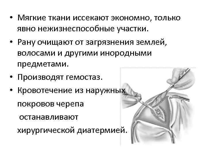  • Мягкие ткани иссекают экономно, только явно нежизнеспособные участки. • Рану очищают от