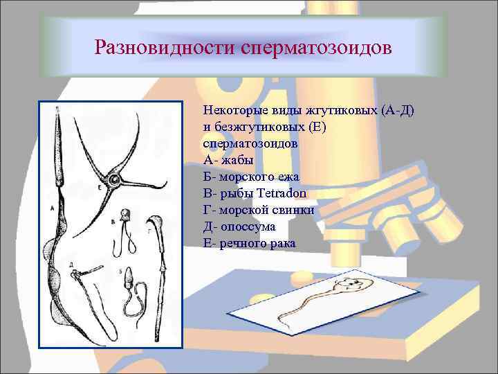 Разновидности сперматозоидов Некоторые виды жгутиковых (А-Д) и безжгутиковых (Е) сперматозоидов А- жабы Б- морского