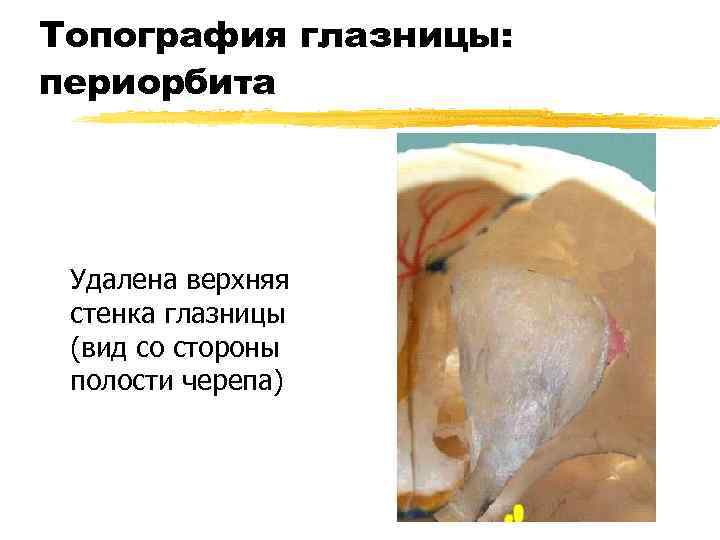 Топография глазницы: периорбита Удалена верхняя стенка глазницы (вид со стороны полости черепа) 