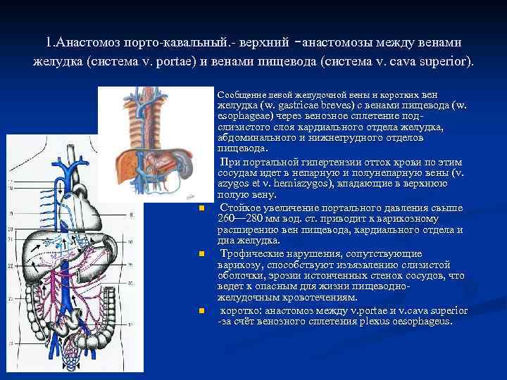 - 1. Анастомоз порто-кавальный. - верхний анастомозы между венами желудка (система v. portae) и