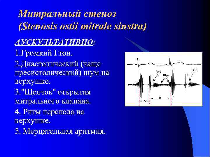 Митральный стеноз (Stenosis ostii mitrale sinstra) АУСКУЛЬТАТИВНО: 1. Громкий I тон. 2. Диастолический (чаще