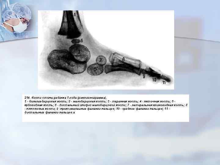 214. Кости стопы ребенка 1 года (рентгенограмма). 1 - болыыеберцовая кость; 2 - малоберцовая