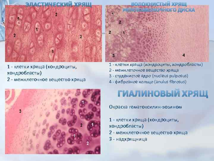 ЭЛАСТИЧЕСКИЙ ХРЯЩ 1 - клетки хряща (хондроциты, хондробласты) 2 - межклеточное вещество хряща ВОЛОКНИСТЫЙ