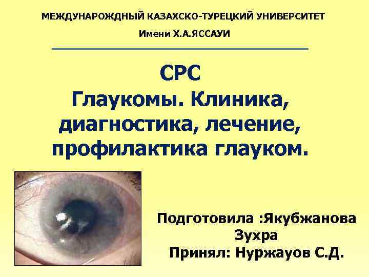 МЕЖДУНАРОЖДНЫЙ КАЗАХСКО-ТУРЕЦКИЙ УНИВЕРСИТЕТ Имени Х. А. ЯССАУИ СРС Глаукомы. Клиника, диагностика, лечение, профилактика глауком.