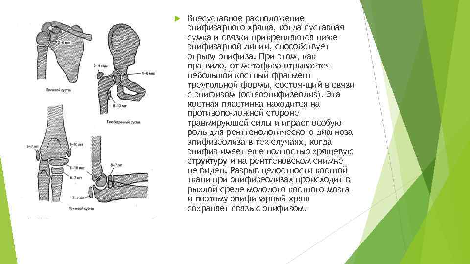 Эпифизарный хрящ. Особенности переломов у детей. Эпифизарный хрящ кости. Внесуставное расположение эпифизарного хряща.