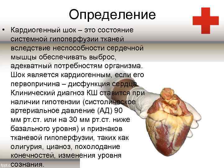 Определение • Кардиогенный шок – это состояние системной гипоперфузии тканей вследствие неспособности сердечной мышцы