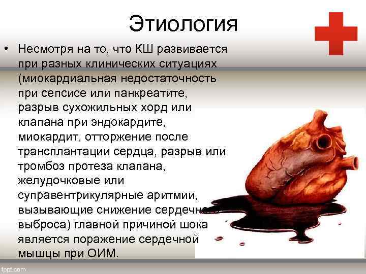 Этиология • Несмотря на то, что КШ развивается при разных клинических ситуациях (миокардиальная недостаточность