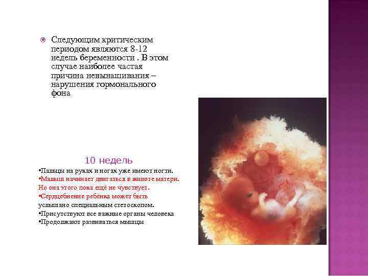  Следующим критическим периодом являются 8 -12 недель беременности. В этом случае наиболее частая
