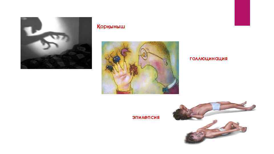 Қорқыныш голлюцинация эпилепсия 