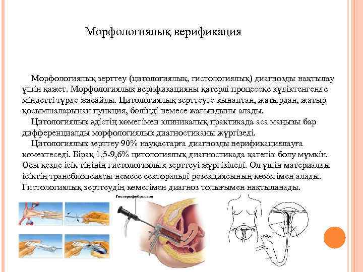Морфологиялық верификация Морфологиялық зерттеу (цитологиялық, гистологиялық) диагнозды нақтылау үшін қажет. Морфологиялық верификацияны қатерлі процесске