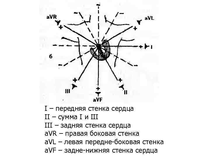 І – передняя стенка сердца ІІ – сумма І и ІІІ – задняя стенка