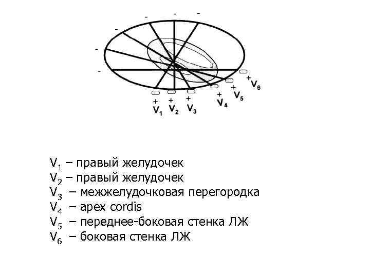 V 1 V 2 V 3 V 4 V 5 V 6 – правый