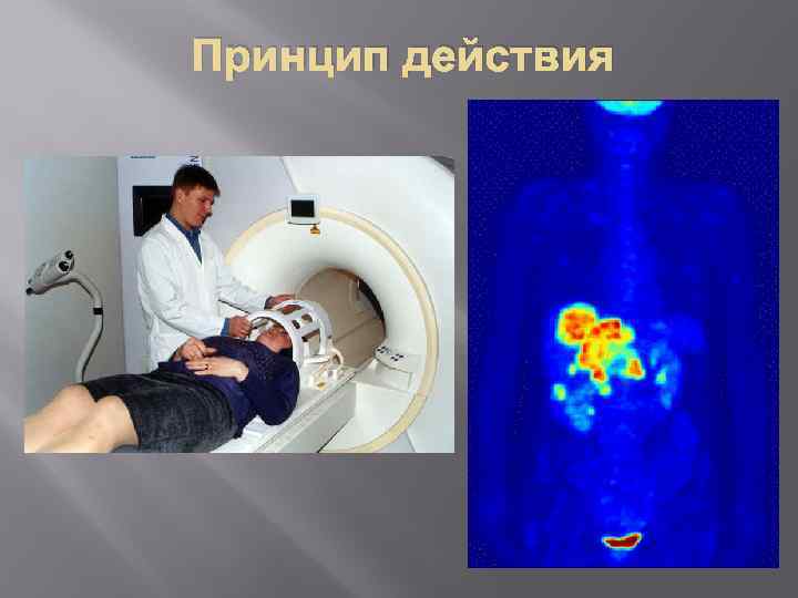 Принцип действия 