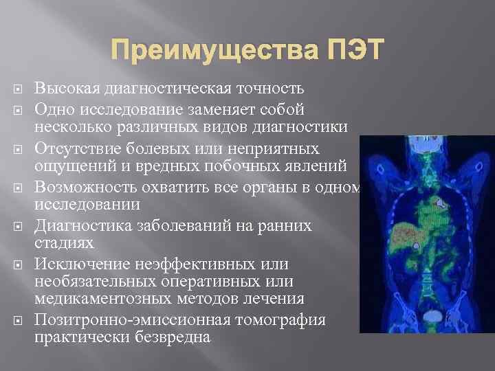 Преимущества ПЭТ Высокая диагностическая точность Одно исследование заменяет собой несколько различных видов диагностики Отсутствие