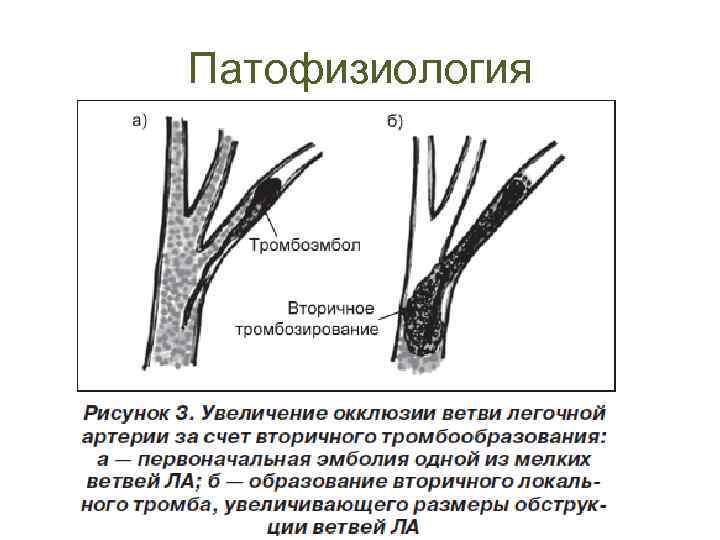 Патофизиология 