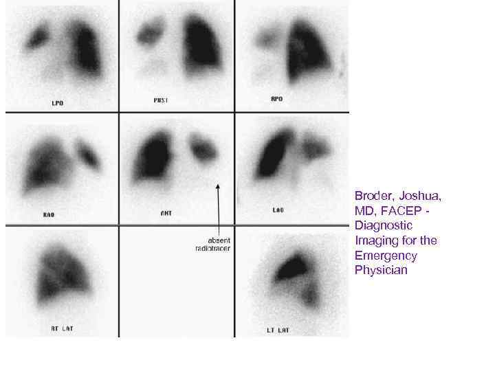 Broder, Joshua, MD, FACEP - Diagnostic Imaging for the Emergency Physician 