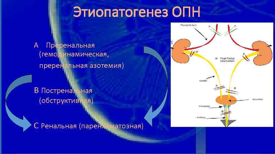 Этиопатогенез ОПН А Преренальная (гемодинамическая, преренальная азотемия) В Постренальная (обструктивная) С Ренальная (паренхиматозная) 