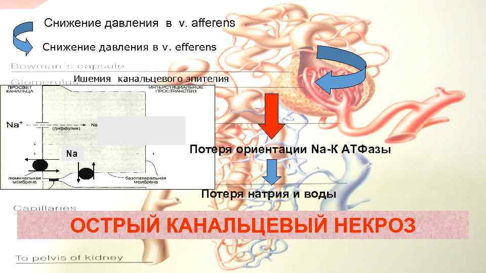 Снижение давления в v. afferens Снижение давления в v. efferens Ишемия канальцевого эпителия Na