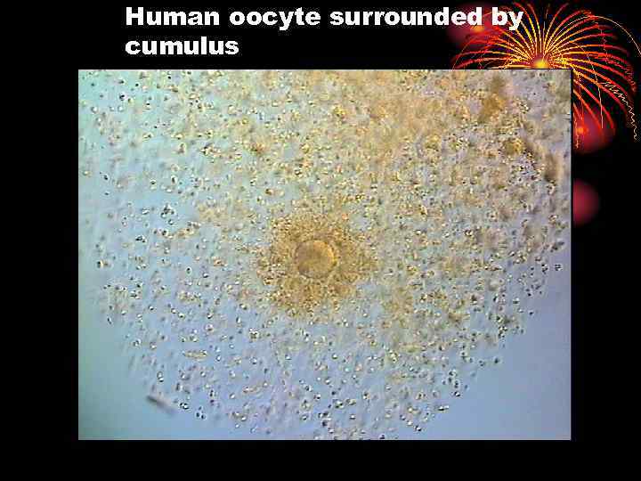 Human oocyte surrounded by cumulus 