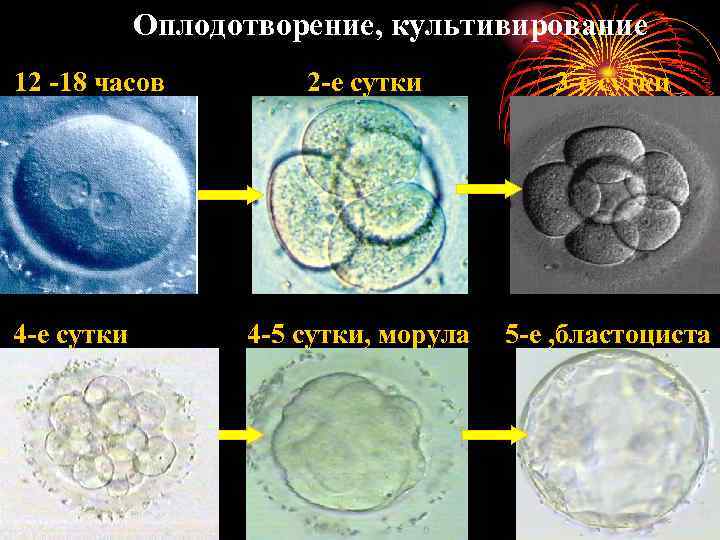 Оплодотворение, культивирование 12 -18 часов 4 -е сутки 2 -е сутки 3 -е сутки