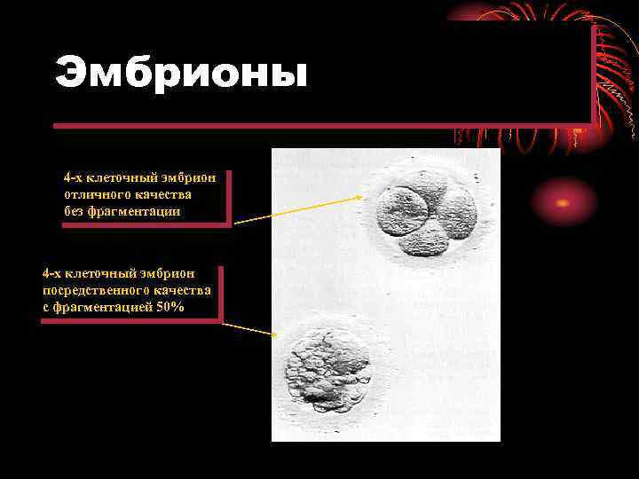 Эмбрионы 4 -х клеточный эмбрион отличного качества без фрагментации 4 -х клеточный эмбрион посредственного