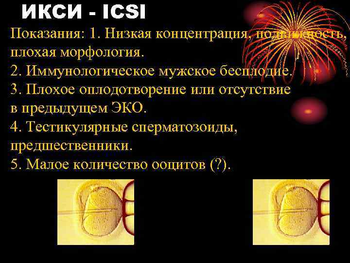 ИКСИ - ICSI Показания: 1. Низкая концентрация, подвижность, плохая морфология. 2. Иммунологическое мужское бесплодие.