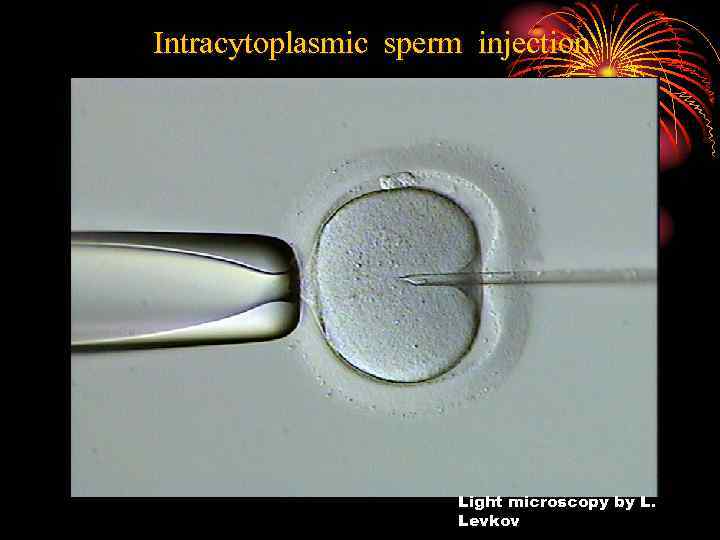 Intracytoplasmic sperm injection Light microscopy by L. Levkov 