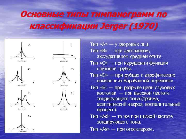 Основные типы тимпанограмм по классификации Jerger (1970) Тип «А» — у здоровых лиц Тип